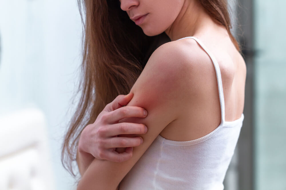 Here's when to worry about a rash in adults - VSM Pharmacy