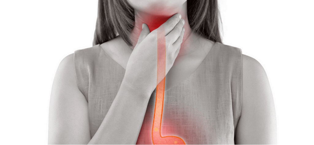 Woman with sore throat