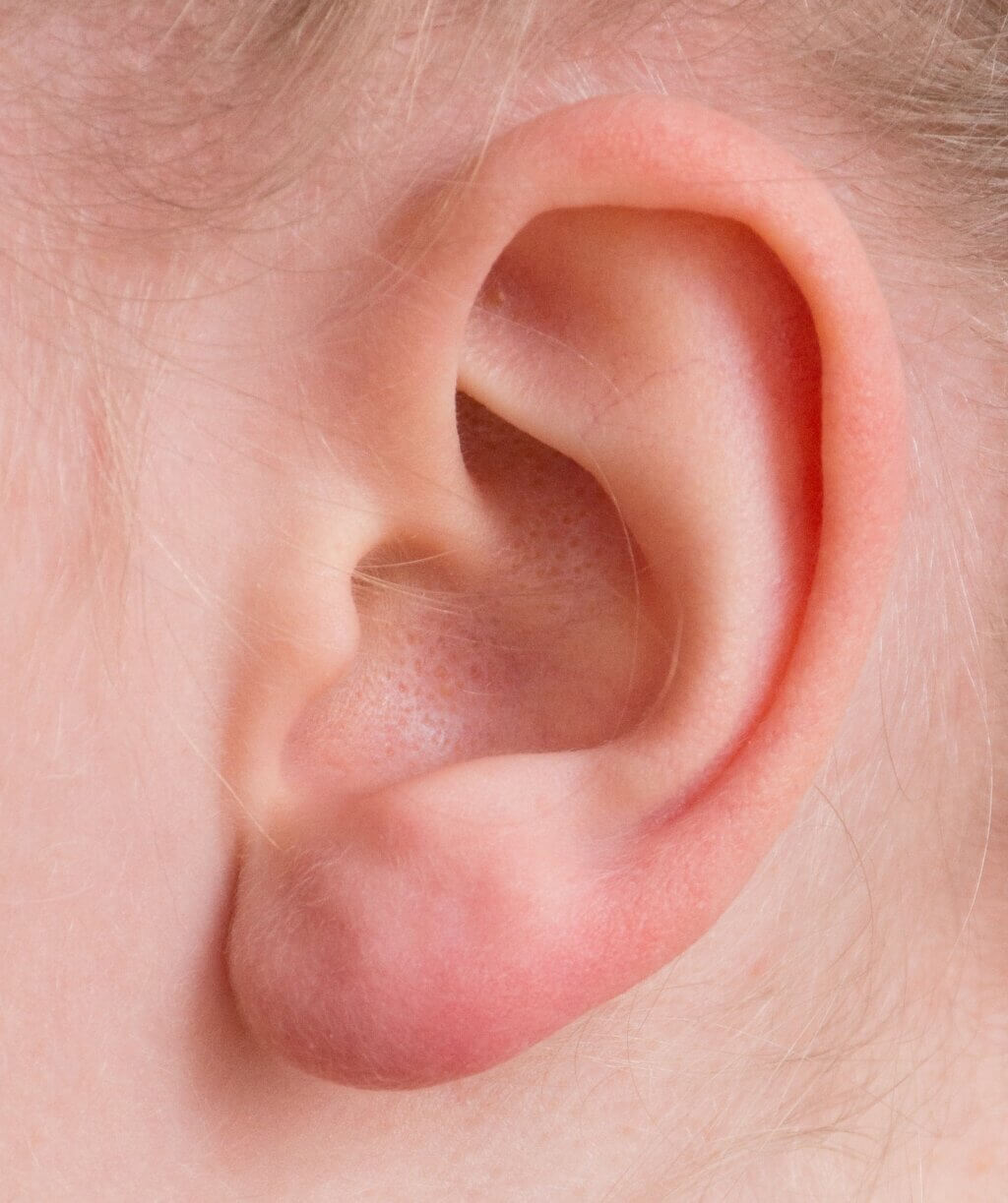 Photograph of a person's ear.